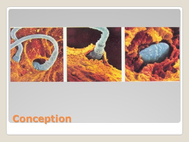 Conception 