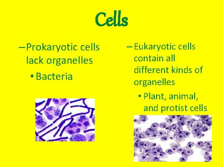 Cells – Prokaryotic cells lack organelles • Bacteria – Eukaryotic cells contain all different