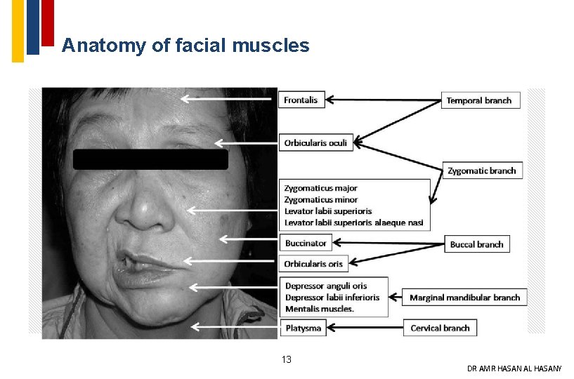 Anatomy of facial muscles 13 DR AMR HASAN AL HASANY 