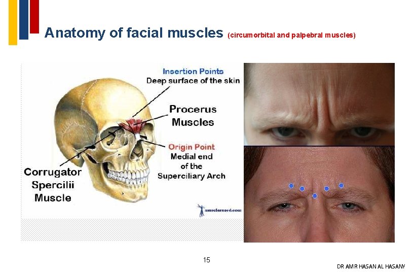 Anatomy of facial muscles (circumorbital and palpebral muscles) 15 DR AMR HASAN AL HASANY