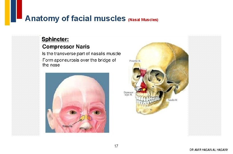 Anatomy of facial muscles (Nasal Muscles) 17 DR AMR HASAN AL HASANY 