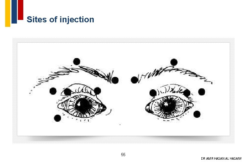 Sites of injection 55 DR AMR HASAN AL HASANY 