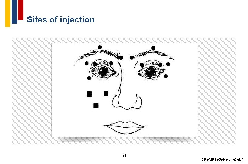 Sites of injection 56 DR AMR HASAN AL HASANY 