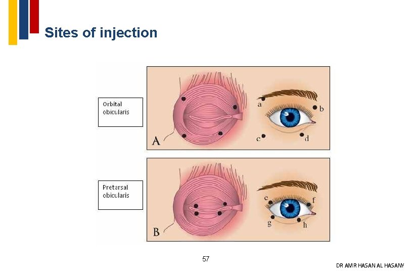 Sites of injection 57 DR AMR HASAN AL HASANY 