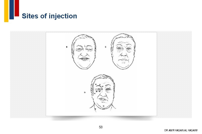 Sites of injection 58 DR AMR HASAN AL HASANY 