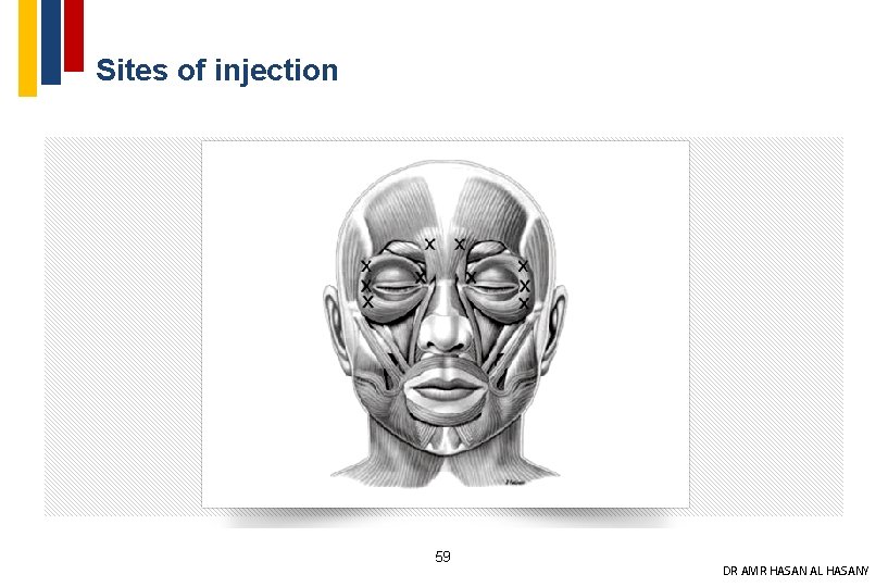Sites of injection 59 DR AMR HASAN AL HASANY 