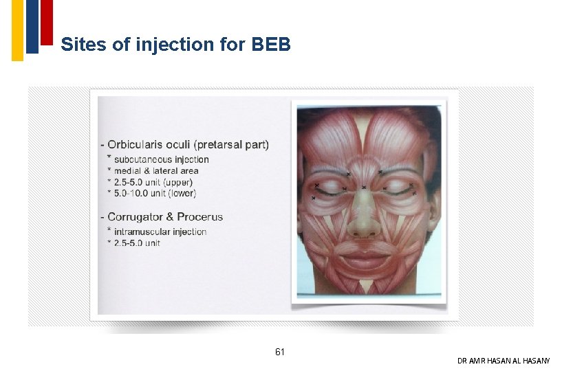 Sites of injection for BEB 61 DR AMR HASAN AL HASANY 