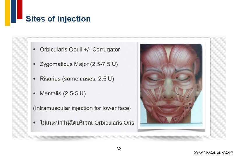 Sites of injection 62 DR AMR HASAN AL HASANY 