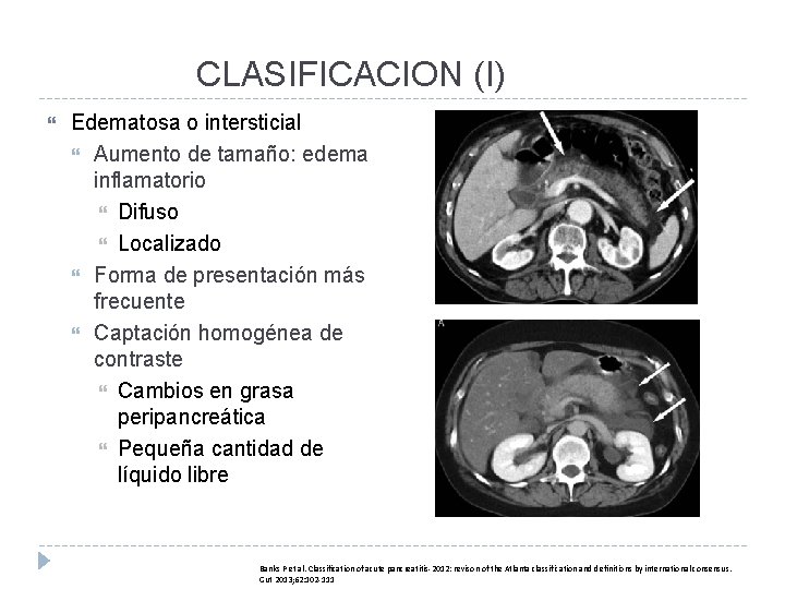 CLASIFICACION (I) Edematosa o intersticial Aumento de tamaño: edema inflamatorio Difuso Localizado Forma de