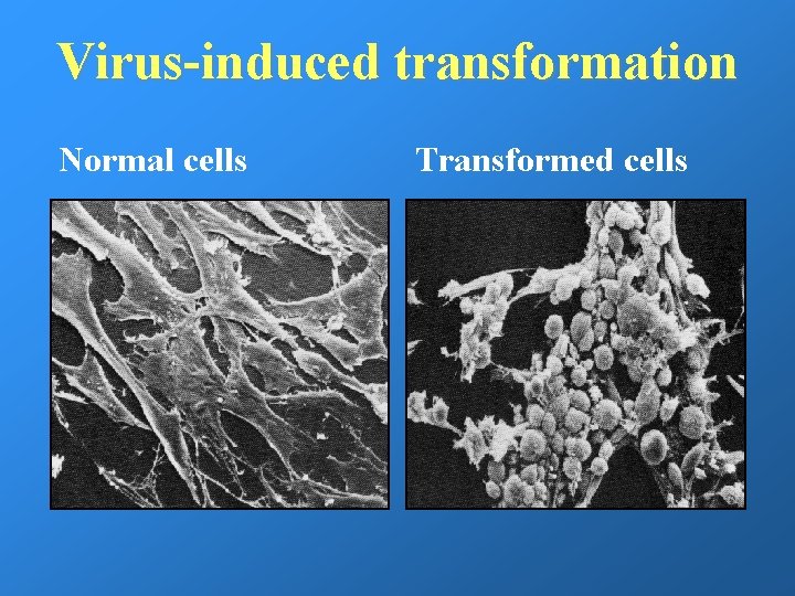 Virus-induced transformation Normal cells Transformed cells 