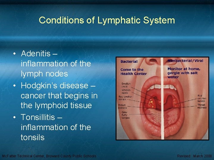 Conditions of Lymphatic System • Adenitis – inflammation of the lymph nodes • Hodgkin’s