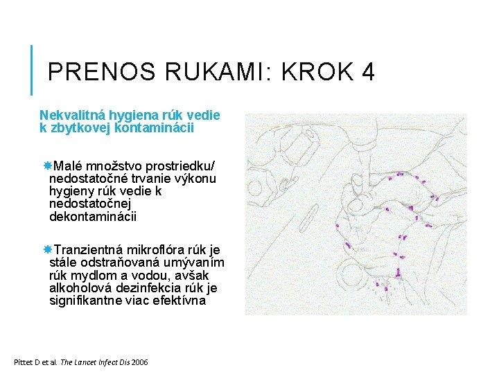 PRENOS RUKAMI: KROK 4 Nekvalitná hygiena rúk vedie k zbytkovej kontaminácii Malé množstvo prostriedku/