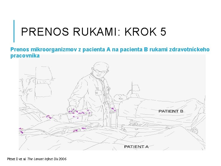 PRENOS RUKAMI: KROK 5 Prenos mikroorganizmov z pacienta A na pacienta B rukami zdravotníckeho