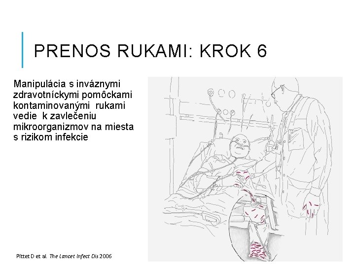 PRENOS RUKAMI: KROK 6 Manipulácia s inváznymi zdravotníckymi pomôckami kontaminovanými rukami vedie k zavlečeniu