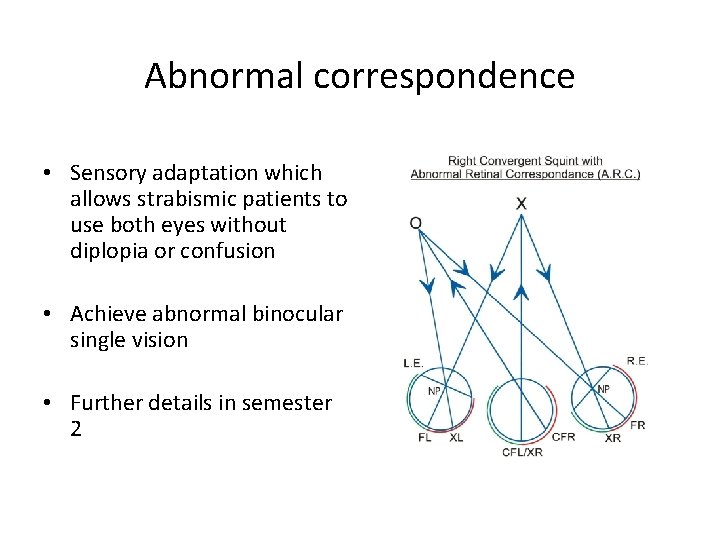 Abnormal correspondence • Sensory adaptation which allows strabismic patients to use both eyes without