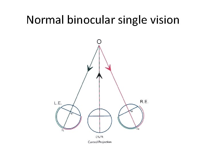 Normal binocular single vision 