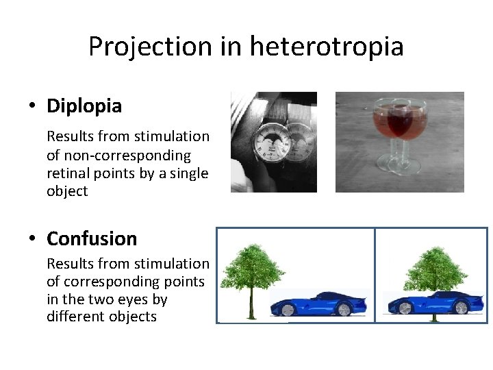 Projection in heterotropia • Diplopia Results from stimulation of non-corresponding retinal points by a