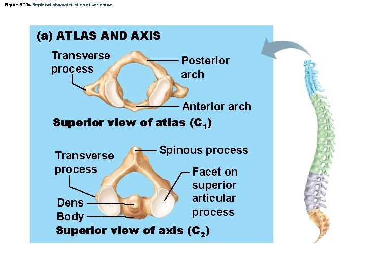 Figure 5. 20 a Regional characteristics of vertebrae. (a) ATLAS AND AXIS Transverse process