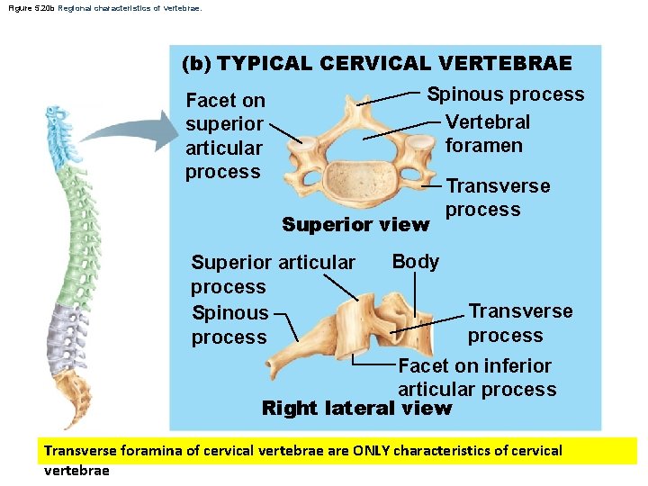 Figure 5. 20 b Regional characteristics of vertebrae. (b) TYPICAL CERVICAL VERTEBRAE Spinous process