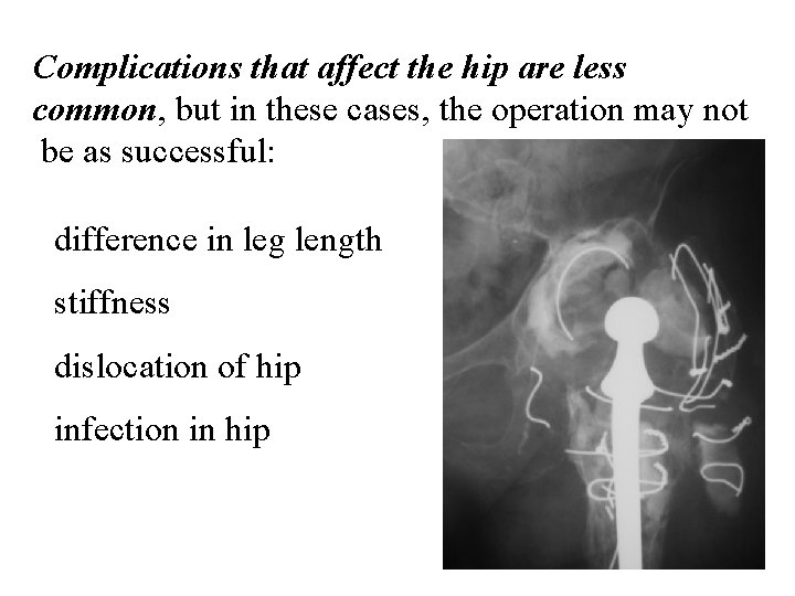 Complications that affect the hip are less common, but in these cases, the operation