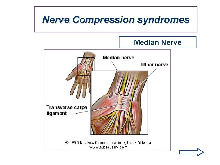 Nerve Compression syndromes Median Nerve 
