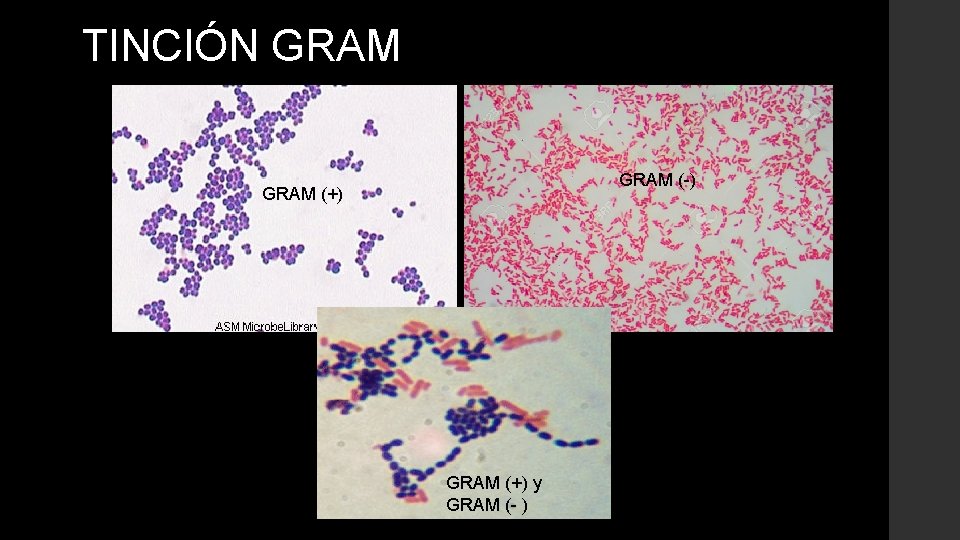 TINCIÓN GRAM (-) GRAM (+) y GRAM (- ) 