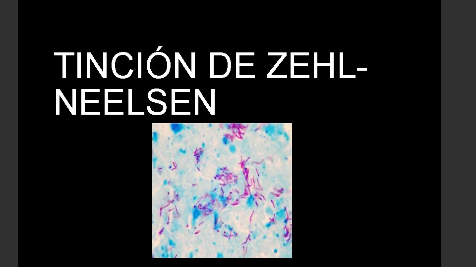 TINCIÓN DE ZEHLNEELSEN 