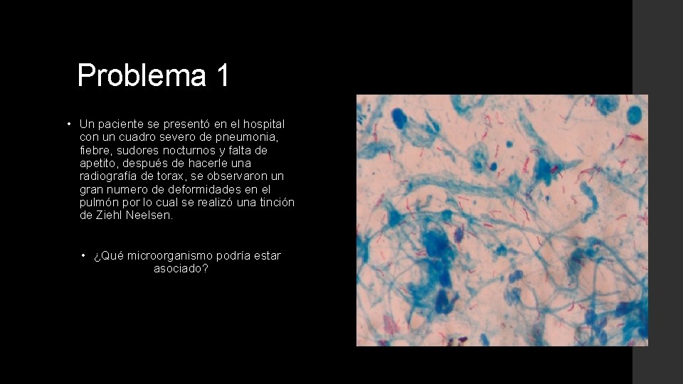 Problema 1 • Un paciente se presentó en el hospital con un cuadro severo