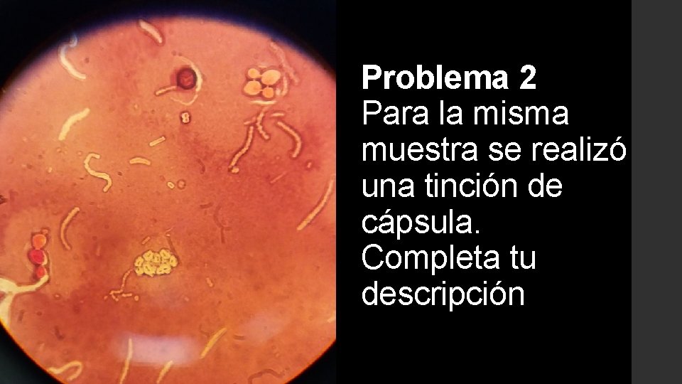 Problema 2 Para la misma muestra se realizó una tinción de cápsula. Completa tu