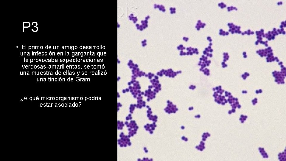 P 3 • El primo de un amigo desarrolló una infección en la garganta