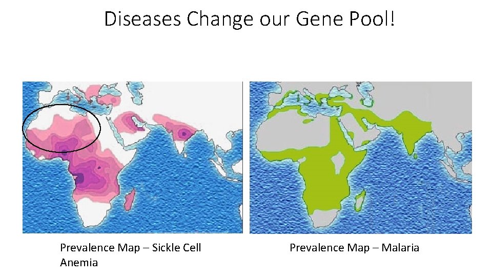 Diseases Change our Gene Pool! Prevalence Map – Sickle Cell Anemia Prevalence Map –