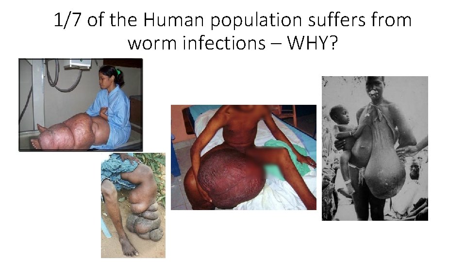 1/7 of the Human population suffers from worm infections – WHY? 