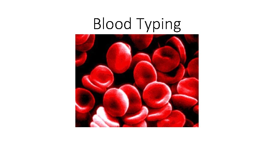 Blood Typing 