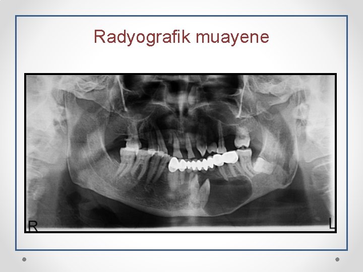 Radyografik muayene 