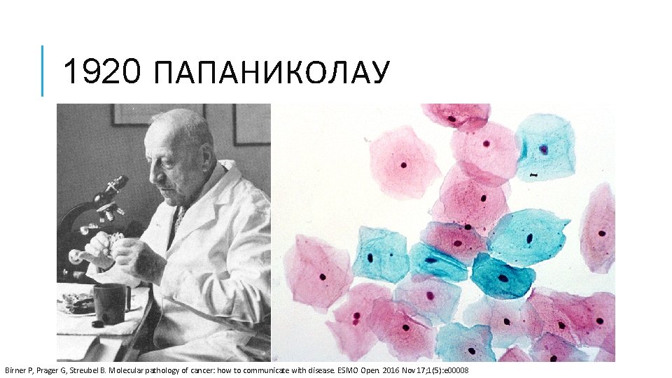 1920 ПАПАНИКОЛАУ Birner P, Prager G, Streubel B. Molecular pathology of cancer: how to