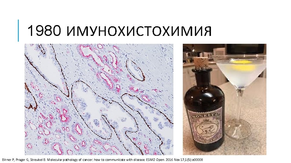 1980 ИМУНОХИСТОХИМИЯ Birner P, Prager G, Streubel B. Molecular pathology of cancer: how to