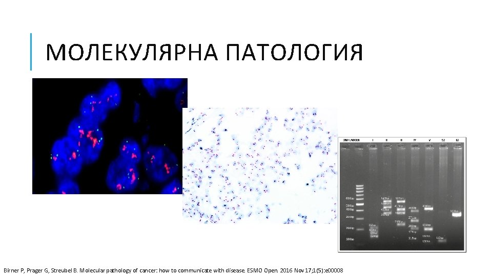 МОЛЕКУЛЯРНА ПАТОЛОГИЯ Birner P, Prager G, Streubel B. Molecular pathology of cancer: how to