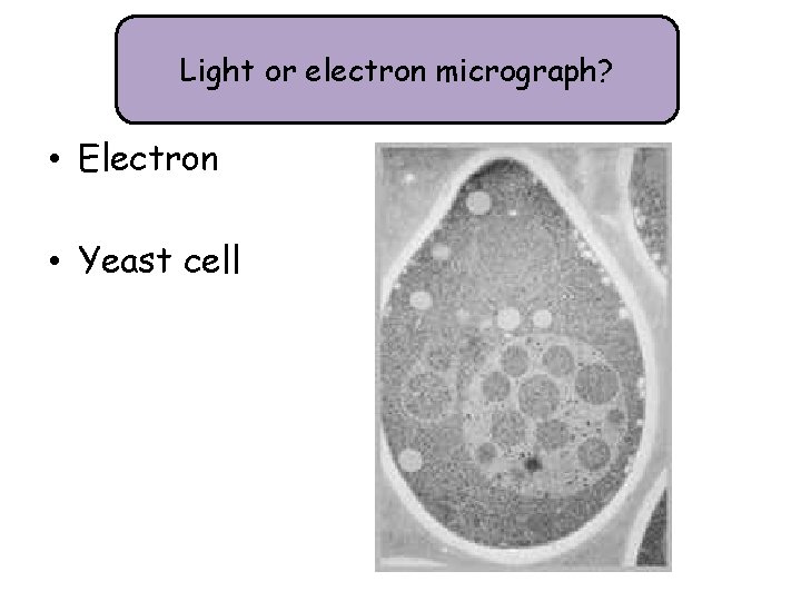 Light or electron micrograph? • Electron • Yeast cell 