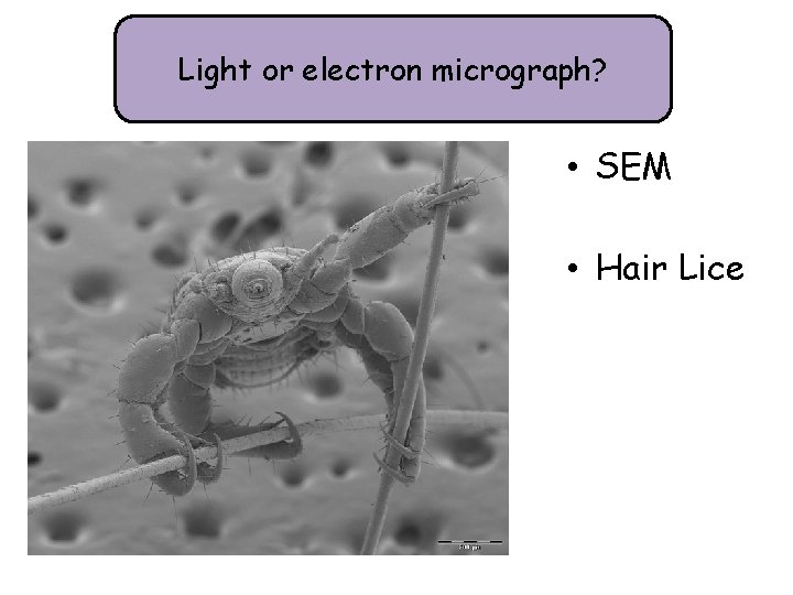 Light or electron micrograph? • SEM • Hair Lice 