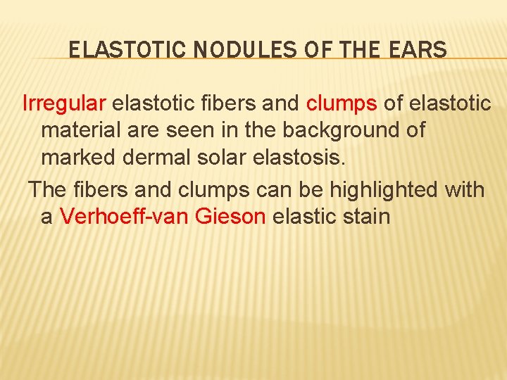 ELASTOTIC NODULES OF THE EARS Irregular elastotic fibers and clumps of elastotic material are