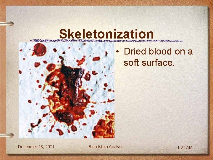 Skeletonization • Dried blood on a soft surface. December 16, 2021 Bloodstain Analysis 1: