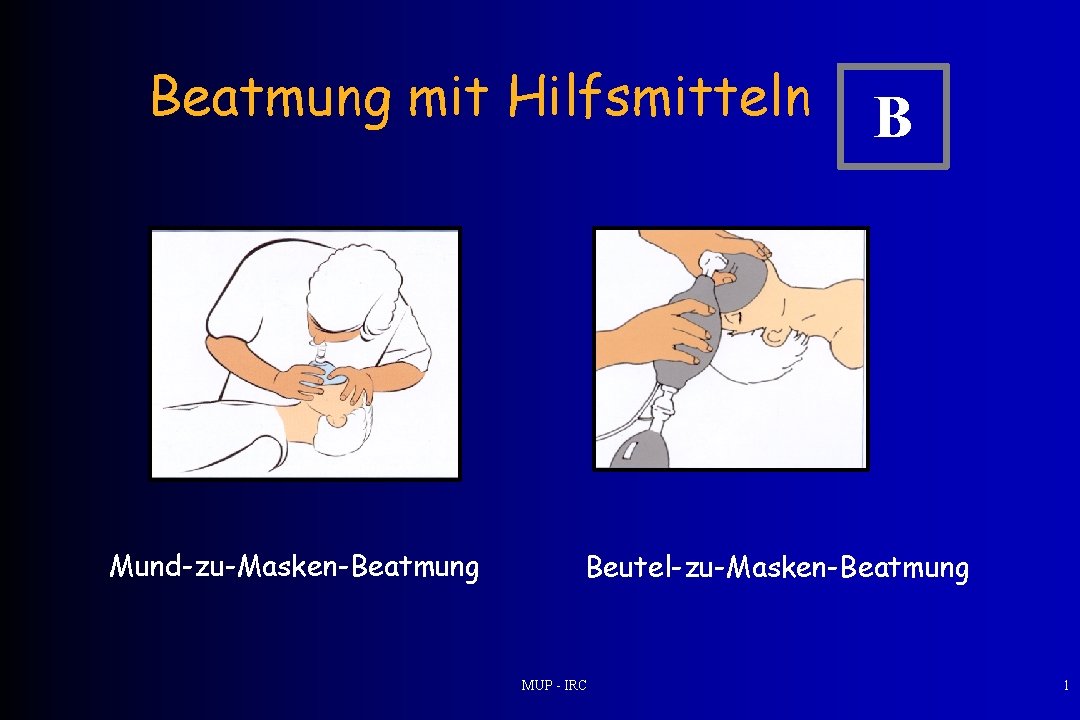 Beatmung mit Hilfsmitteln Mund-zu-Masken-Beatmung B Beutel-zu-Masken-Beatmung MUP - IRC 1 