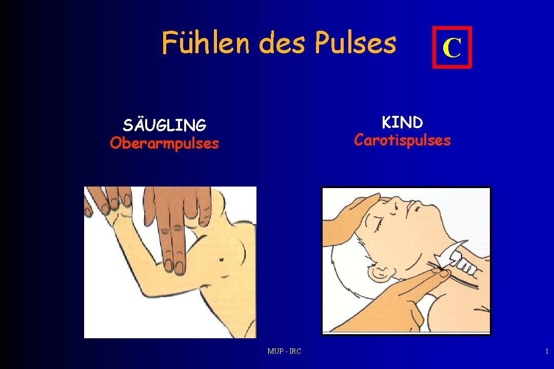 Fühlen des Pulses C KIND Carotispulses SÄUGLING Oberarmpulses MUP - IRC 1 