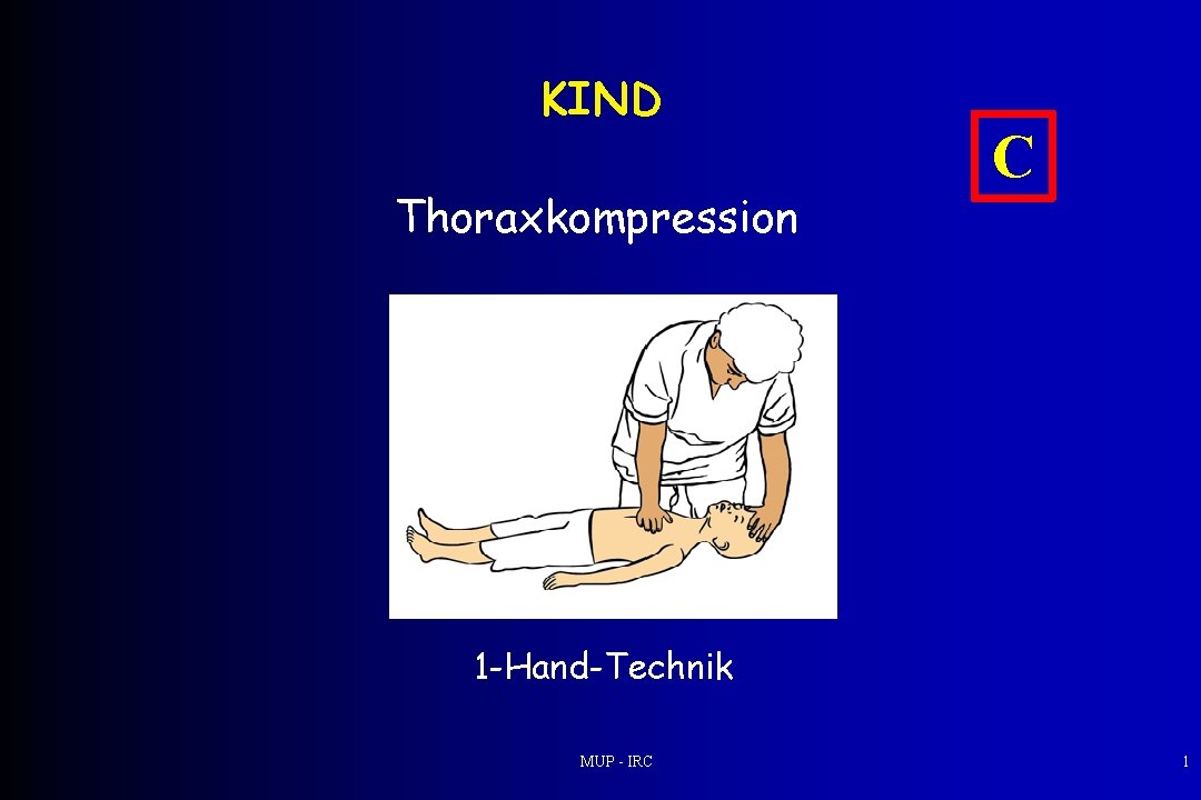 KIND Thoraxkompression C 1 -Hand-Technik MUP - IRC 1 