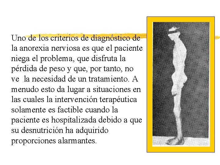 Uno de los criterios de diagnóstico de la anorexia nerviosa es que el paciente