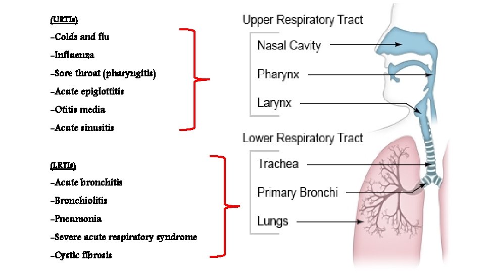 (URTIs) -Colds and flu -Influenza -Sore throat (pharyngitis) -Acute epiglottitis -Otitis media -Acute sinusitis