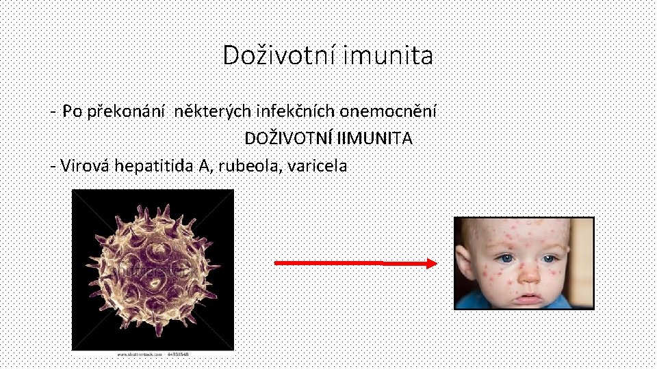 Doživotní imunita - Po překonání některých infekčních onemocnění DOŽIVOTNÍ IIMUNITA - Virová hepatitida A,