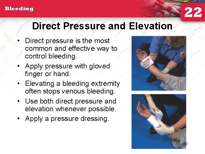 Direct Pressure and Elevation • Direct pressure is the most common and effective way