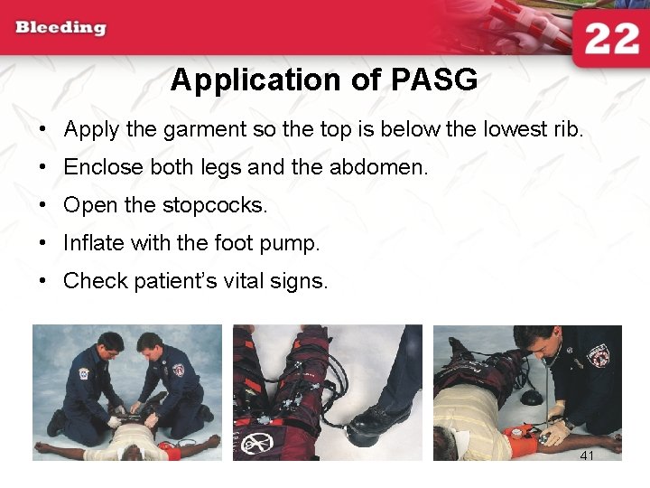 Application of PASG • Apply the garment so the top is below the lowest