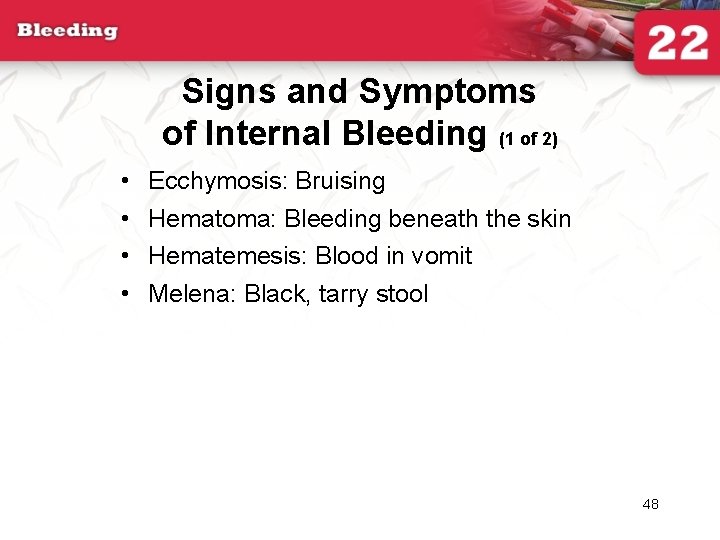 Signs and Symptoms of Internal Bleeding (1 of 2) • • Ecchymosis: Bruising Hematoma:
